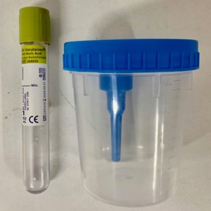Flacon pour urines de 24h, à l'unité – Laboratoire SYNLAB Barla