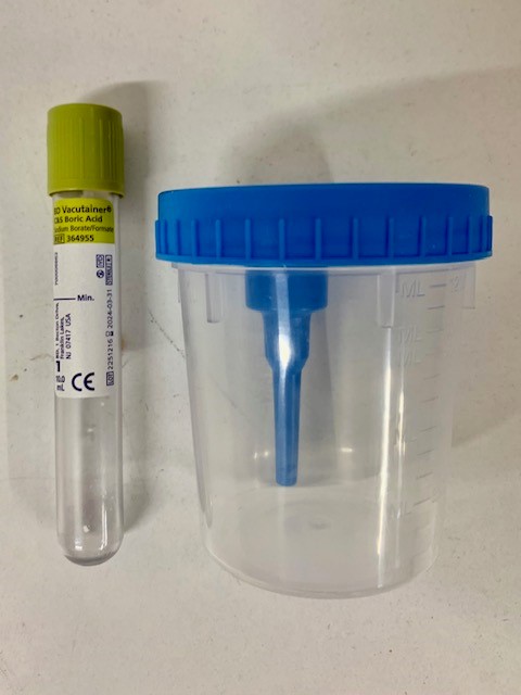Kit collecteur urine 10ml, lot de 5 – Laboratoire SYNLAB Barla