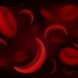 drepanocytose-extender_01ok-150×113