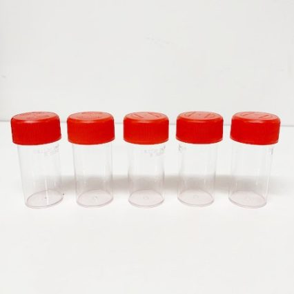 Kit collecteur pour chimie urinaire, lot de 2 – Laboratoire SYNLAB